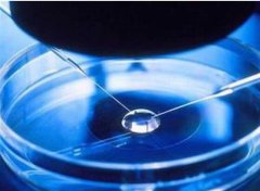 美国试管婴儿中如何来提高胚胎质量?