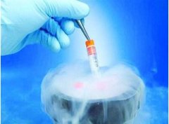 美国试管婴儿中为何要进行胚胎冷冻?