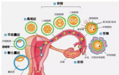　卵巢衰退国内试管失败了多次,美国试管婴儿技