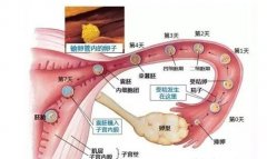 美国试管婴儿中遇到卵泡少怎么办?
